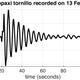 A ‘tornillo’ waveform detected at Cotopaxi volcano